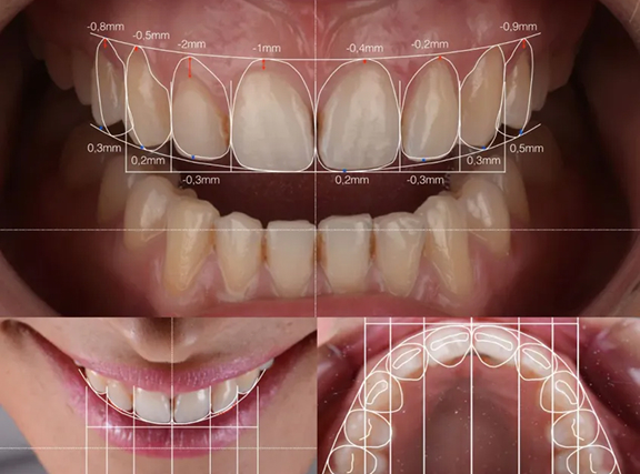 Digital Smile Design
